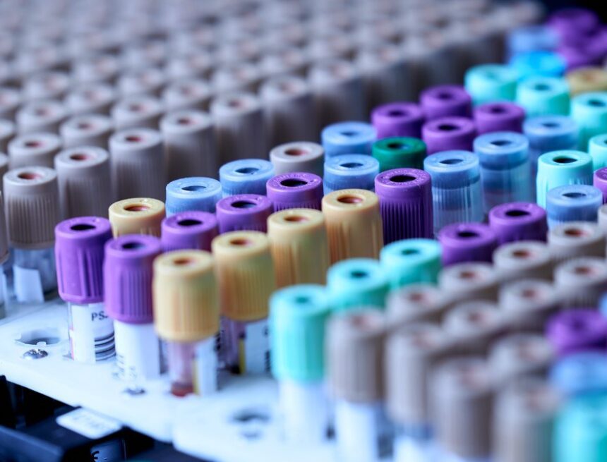 Adenovírus 41: conheça o ‘suspeito’ por surto de ‘hepatite misteriosa’ Adenovírus 41: conheça o ‘suspeito’ por surto de ‘hepatite misteriosa’