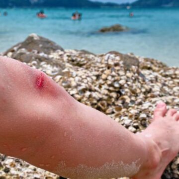 Vorsicht im Kreta-Urlaub: Giftiger Fisch breitet sich rund um die Insel aus