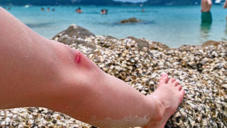 Vorsicht im Kreta-Urlaub: Giftiger Fisch breitet sich rund um die Insel aus