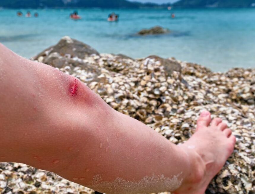 Vorsicht im Kreta-Urlaub: Giftiger Fisch breitet sich rund um die Insel aus Vorsicht im Kreta-Urlaub: Giftiger Fisch breitet sich rund um die Insel aus