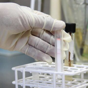Pest-Tod in Russland: Laborantin stirbt nach Reagenzglas-Unfall