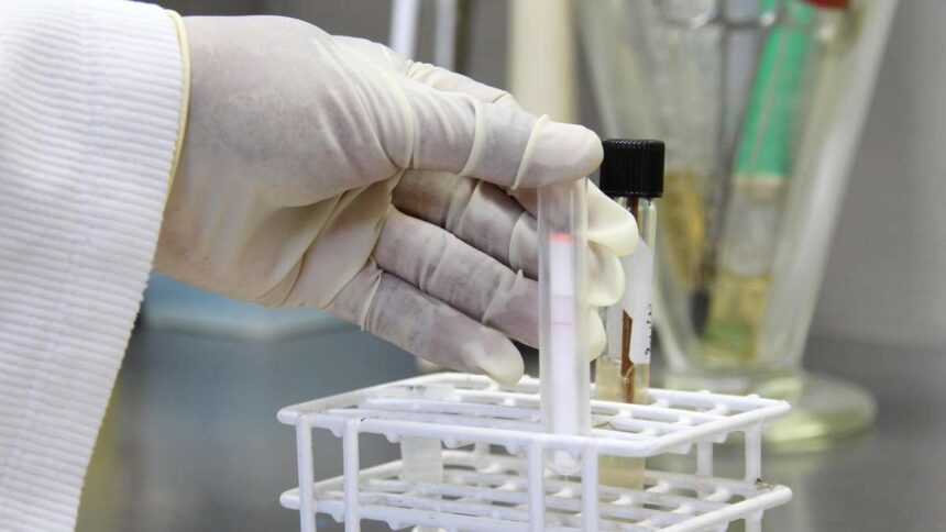 Pest-Tod in Russland: Laborantin stirbt nach Reagenzglas-Unfall